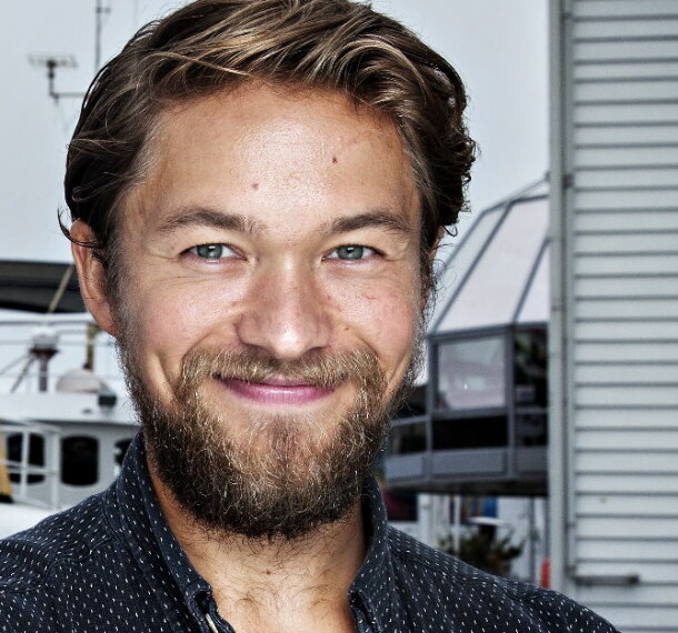 - Alvorlig brannskadet